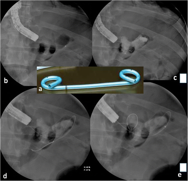 Techniques de chirurgie bariatrique et digestive à paris