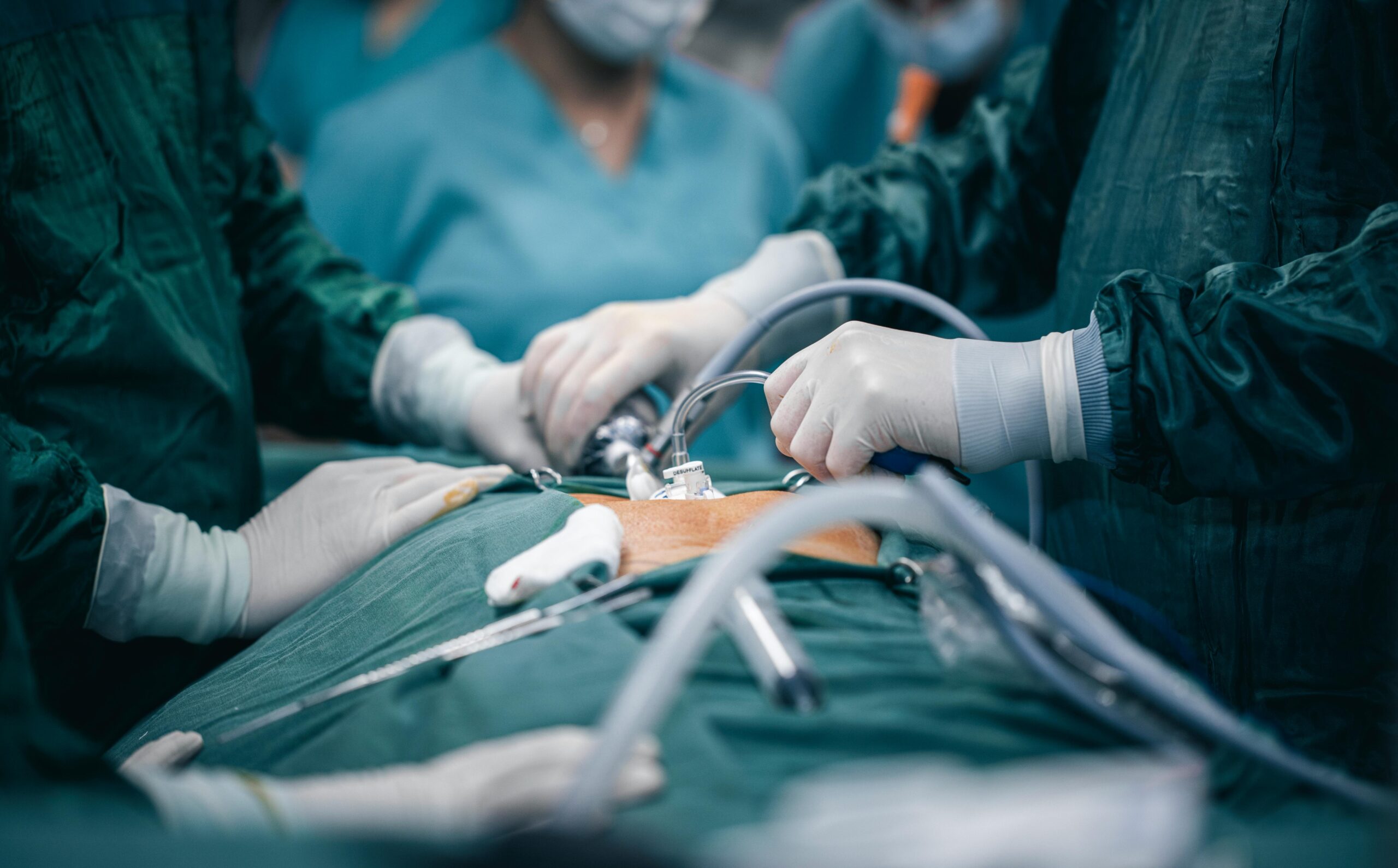 Techniques de chirurgie bariatrique et digestive à paris